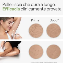 Braun Epilatore Luce Pulsata 100.000Imp